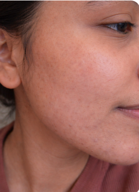 Image #1 from sriya baburaj